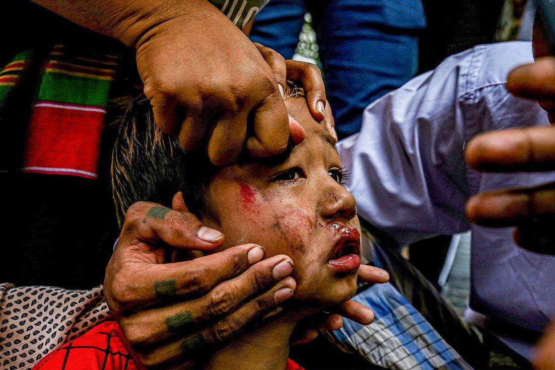 059 myanmarrr މިޔަންމާގެ ކުޑަކުއްޖެއް