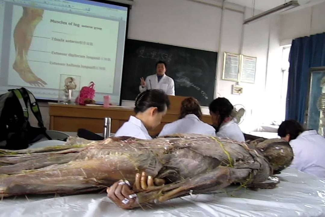 މެޑިކަލް ކްލާހަށް ގެންގޮސްފައި އޮތް މަރުވެފައިވާ ހަށިގަނޑެއް